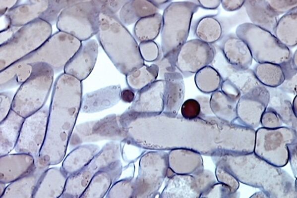 bunky nechtovej huby pod mikroskopom