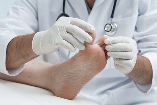 diagnostika plesní nôh lekárom
