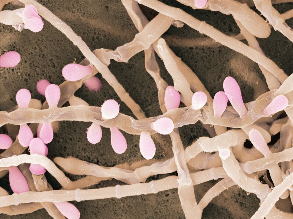 Trichophyton rubrum je druh huby, ktorá postihuje pokožku nôh.